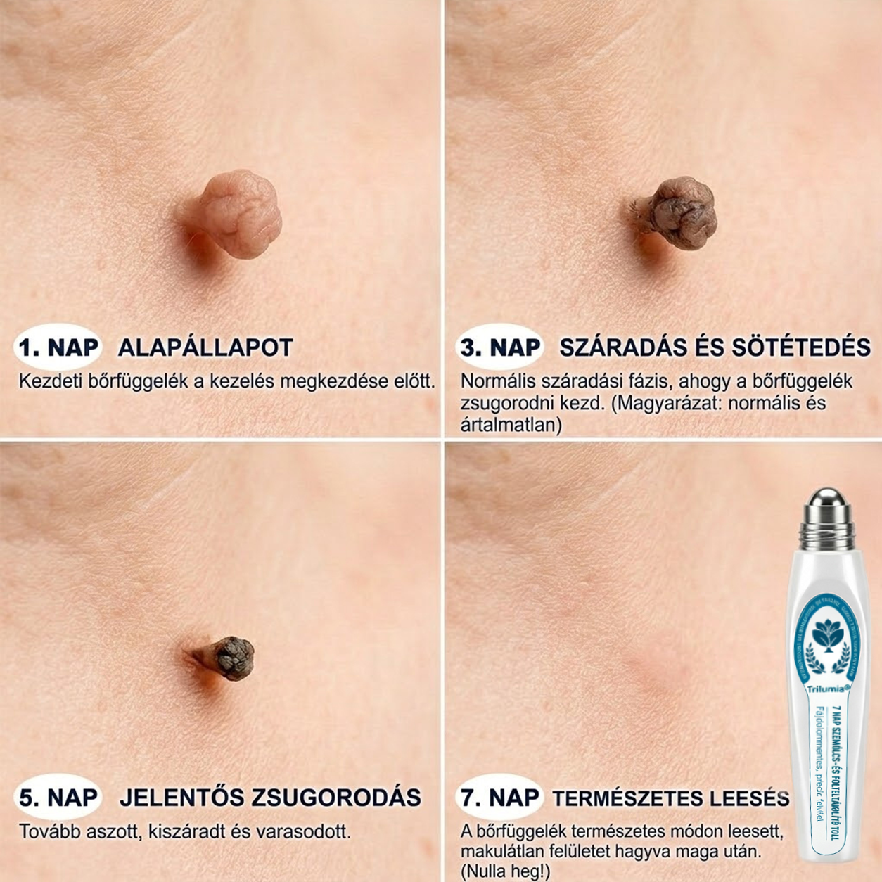 Trilumia Derma-Clear Complex bőrápoló formula