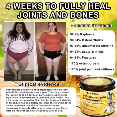 ADNOON™ Botulinum Toxin & Bee Venom Bone Healing Cream